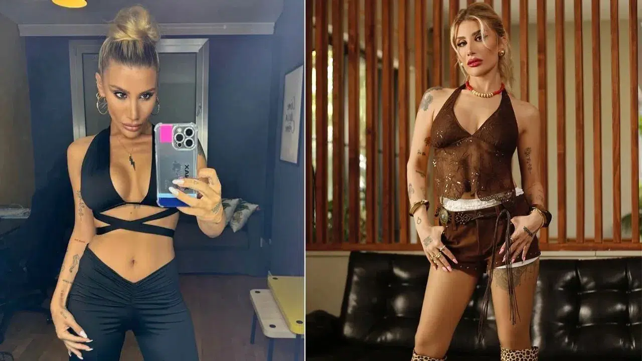 İrem Derici, Evinde Geçirdiği Kaza Hakkında Bilgi Verdi