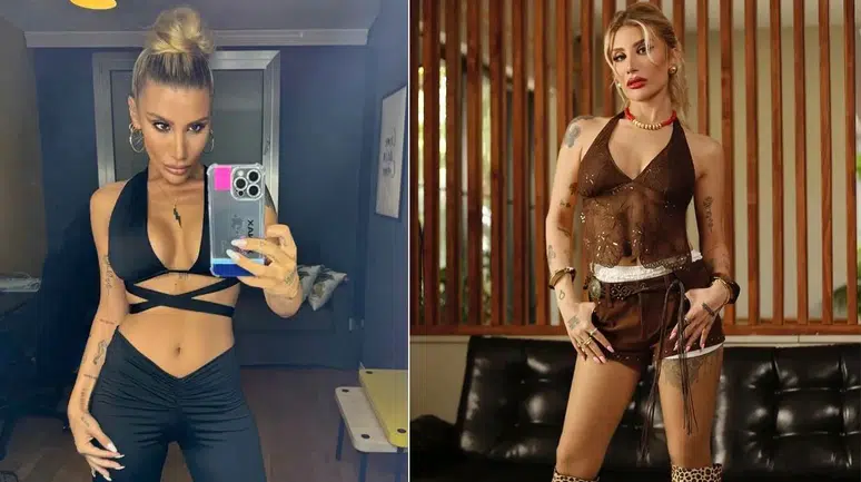 İrem Derici, Evinde Geçirdiği Kaza Hakkında Bilgi Verdi